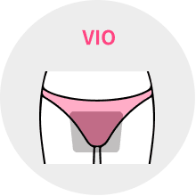 VIO